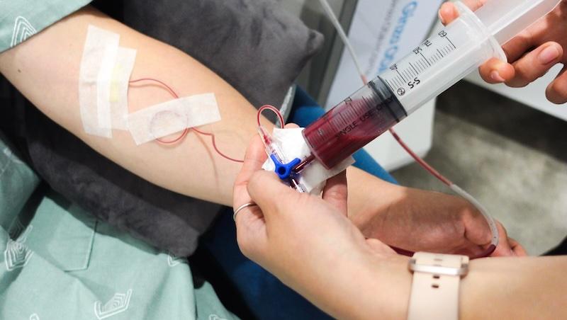 자가혈액 70-100cc 채취 사진