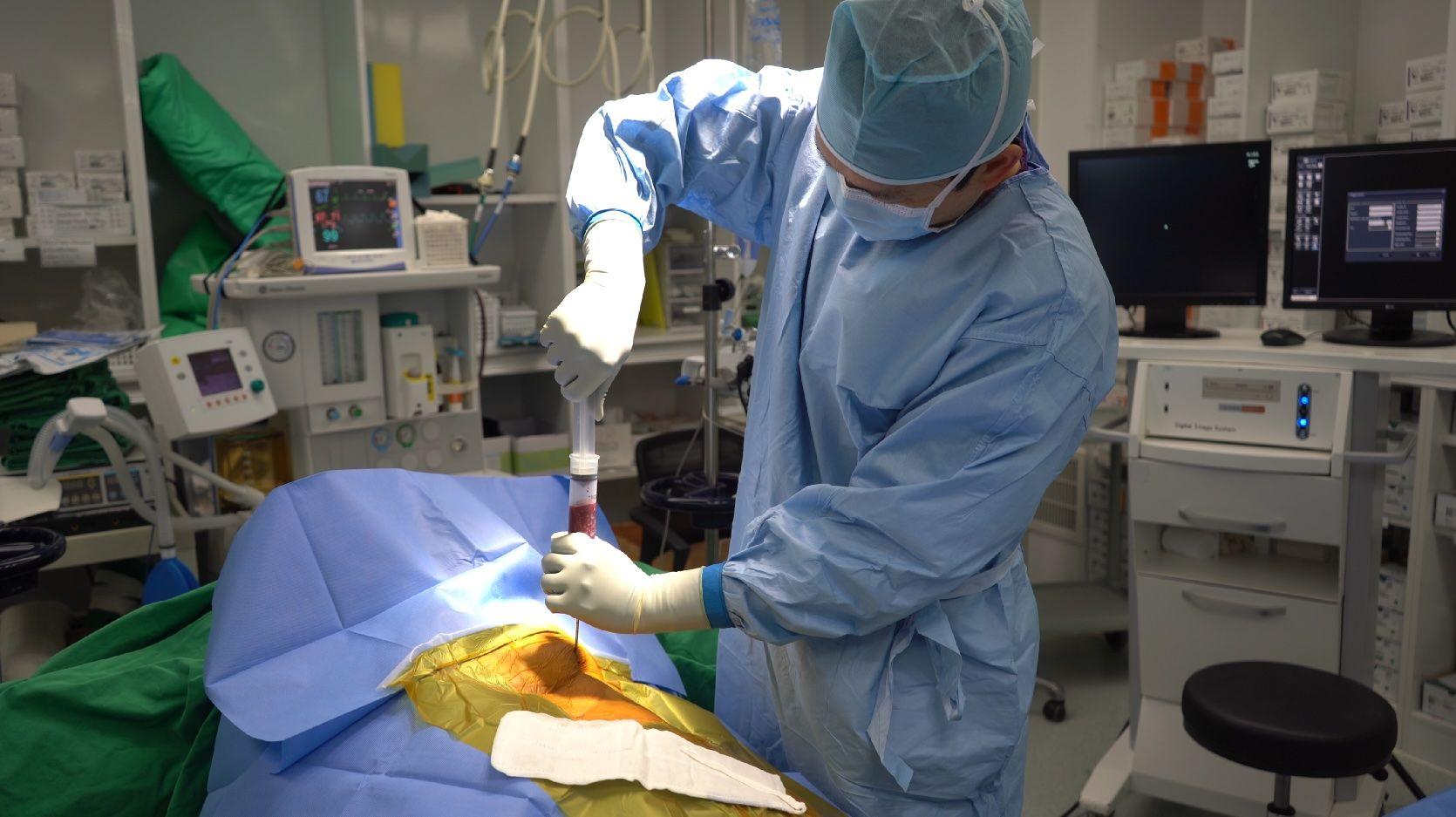 Harvest a small amount of bone marrow under local anesthesia from the pelvic bone
