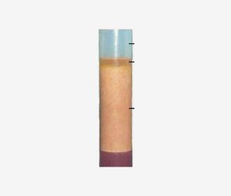 Blood and Tissue Collection